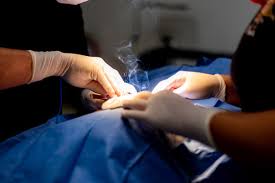 Cauterization is an effective modern medical procedure