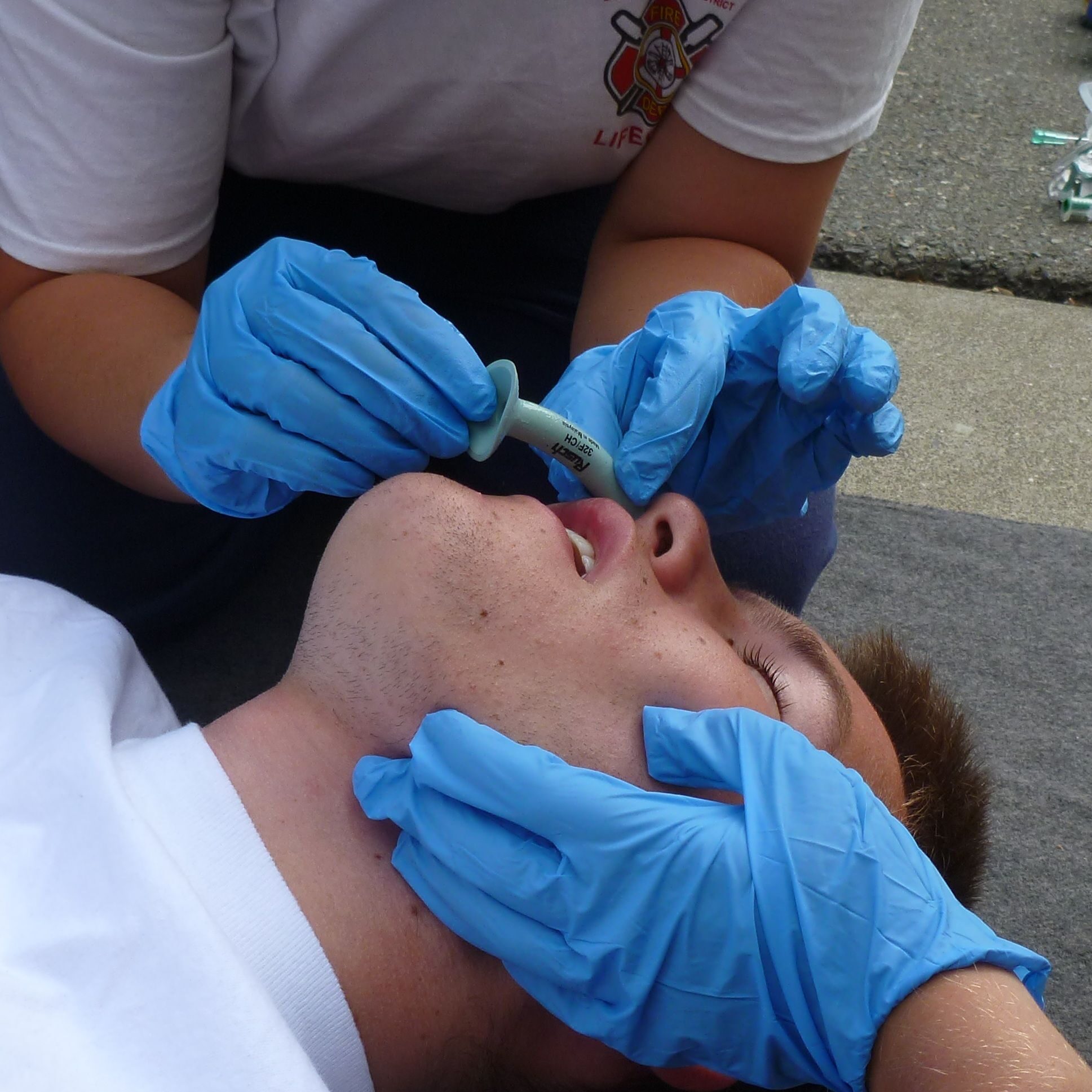 airway management